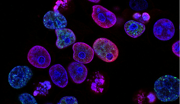 Biopsy